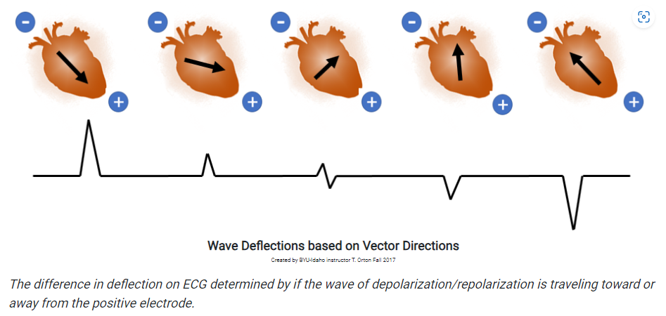 waveDeflections